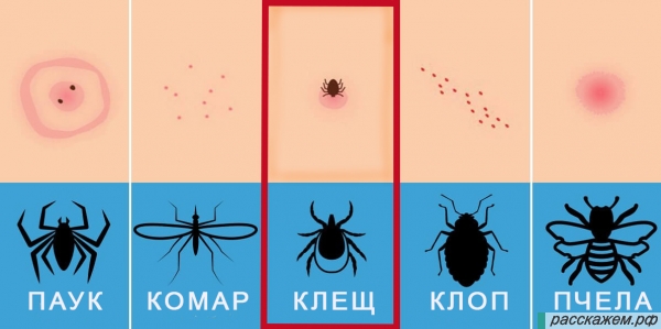 места укусов насекомых, как выглядат места укусов, паука, комара, клеща, клопа, пчелы